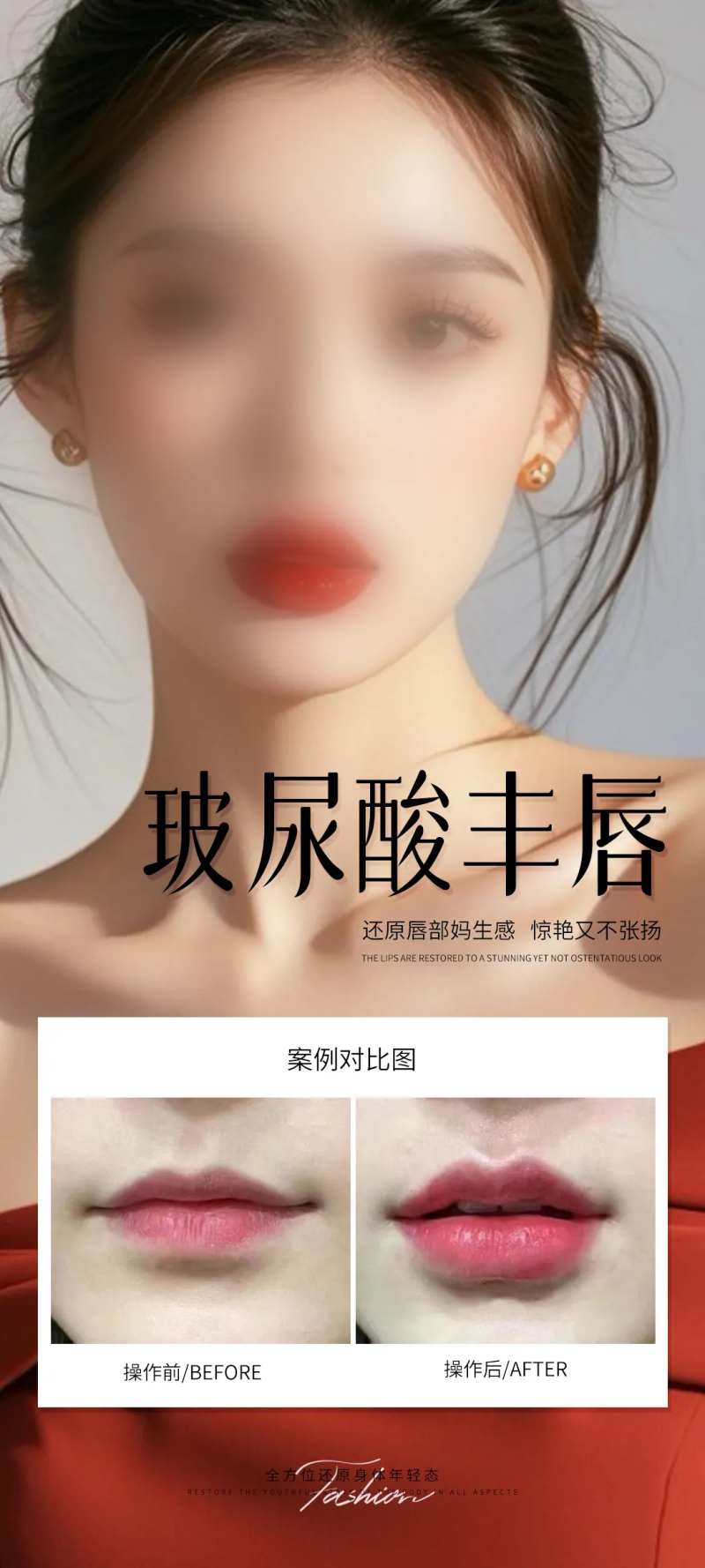 医美玻尿酸丰唇案例海报-采灵感-cailinggan.com