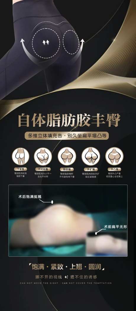 自体脂肪丰臀海报-采灵感-https://www.cailinggan.com/