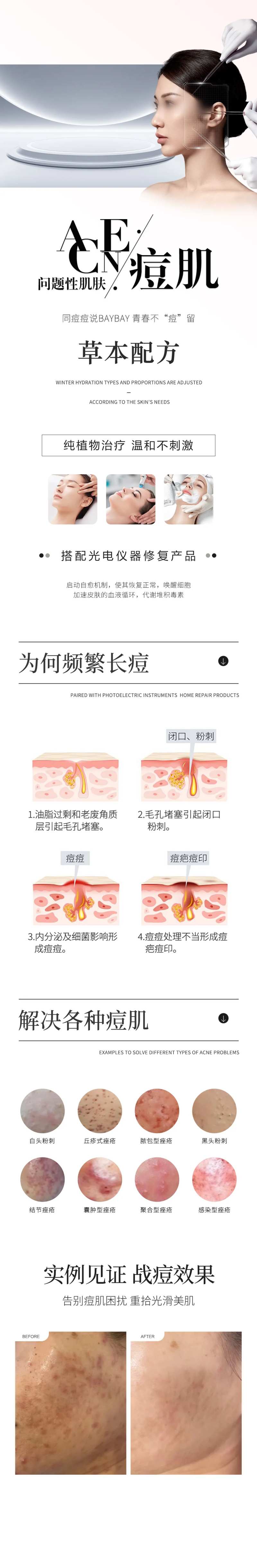 问题性肌肤痘痘-采灵感-cailinggan.com