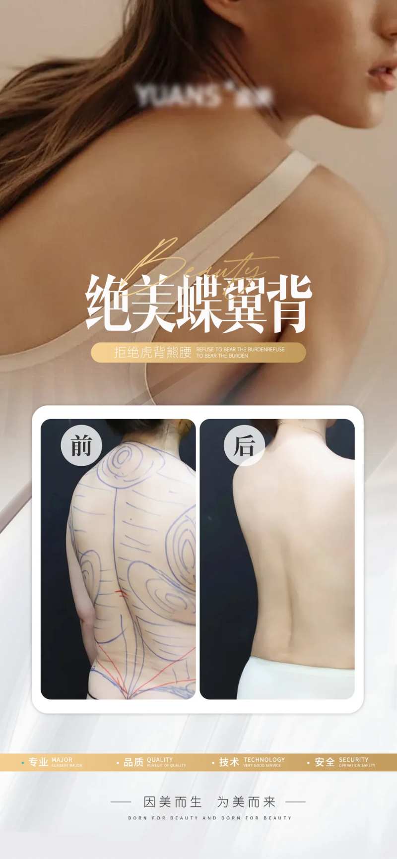 医美后背抽脂案例-采灵感-cailinggan.com