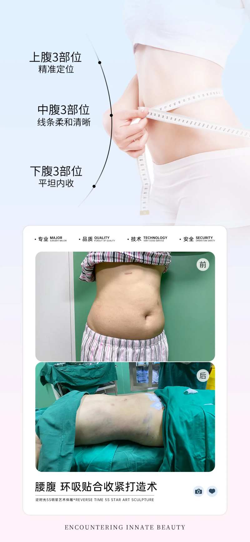 腹部吸脂案例对比宣传海报-采灵感-cailinggan.com