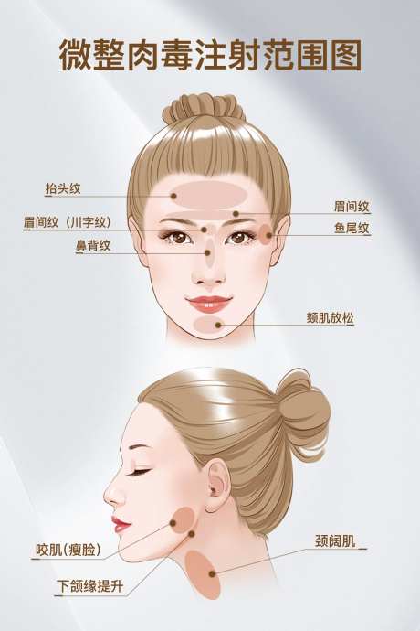 微整肉毒注射点位图.-采灵感-https://www.cailinggan.com/