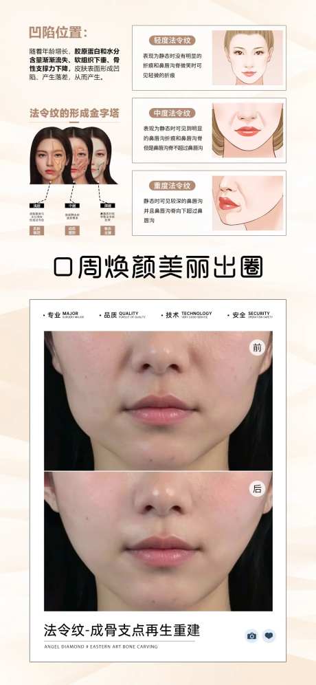 法令纹案例对比海报-采灵感-https://www.cailinggan.com/