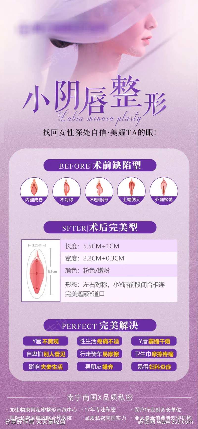 小阴唇整形-采灵感-cailinggan.com