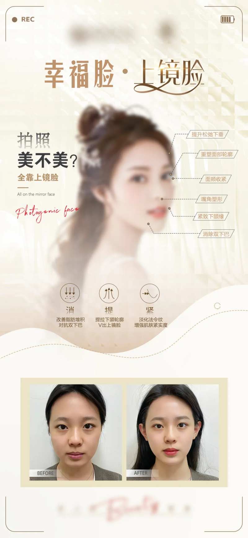 医美上镜脸面部对比图-采灵感-cailinggan.com