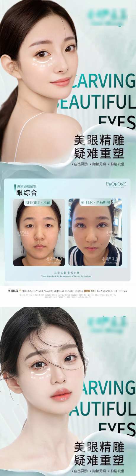 医美眼综合案例系列海报-采灵感-https://www.cailinggan.com/