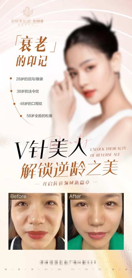 结果逆龄之美案例对比海报-采灵感-https://www.cailinggan.com/