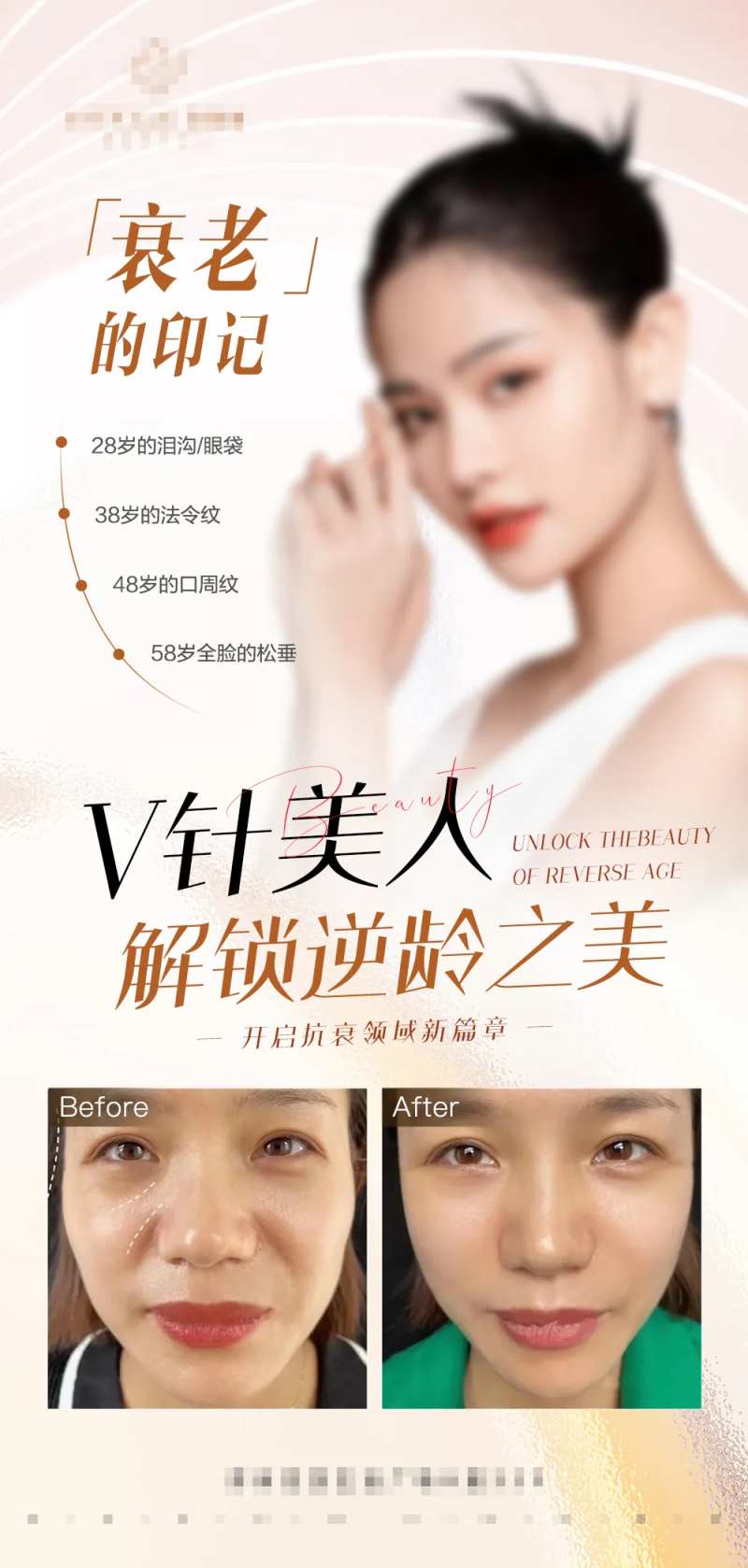 结果逆龄之美案例对比海报-采灵感-cailinggan.com