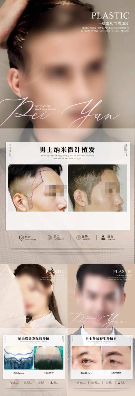 植发案例长图海报-采灵感-https://www.cailinggan.com/