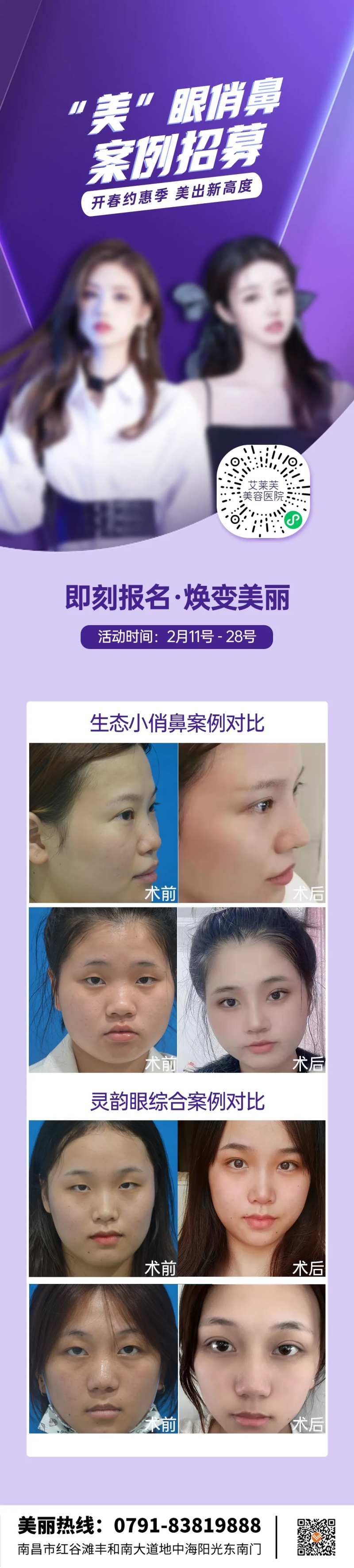 医美美眼俏鼻体验官案例招募-采灵感-cailinggan.com