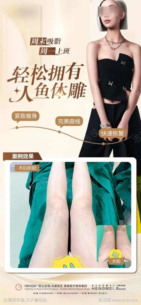 医美大腿吸脂案例-采灵感-https://www.cailinggan.com/