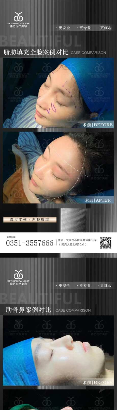 医美案例对比图-采灵感-https://www.cailinggan.com/