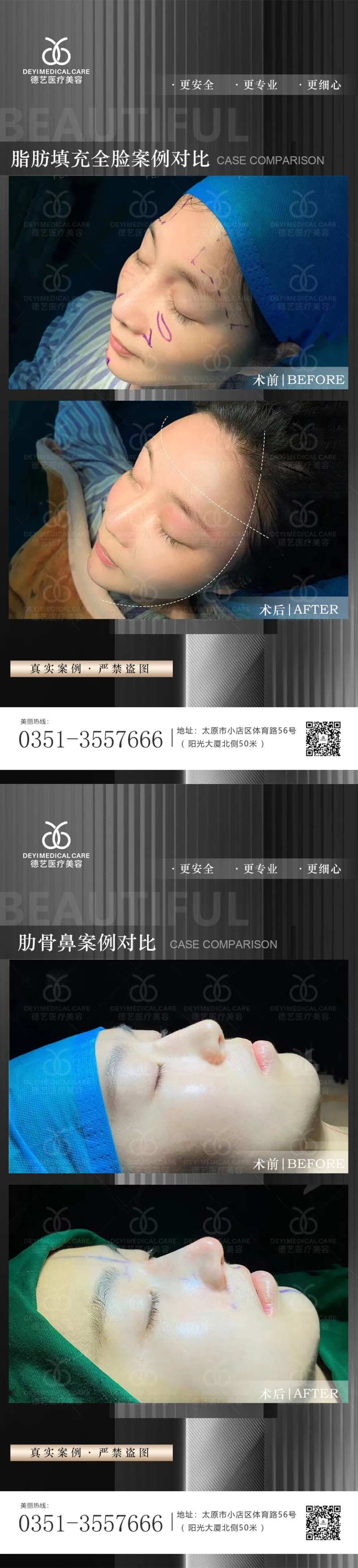 医美案例对比图-采灵感-cailinggan.com