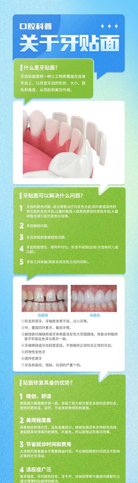 牙齿贴面科普长图-采灵感-https://www.cailinggan.com/