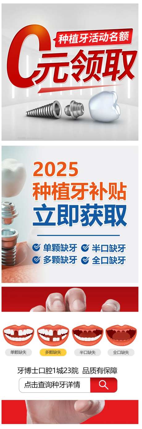 口腔种植牙测价信息流banner海报-采灵感-https://www.cailinggan.com/