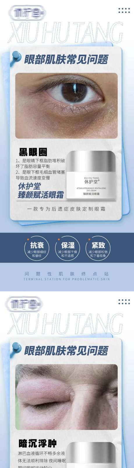 眼部六大问题科普海报-采灵感-https://www.cailinggan.com/