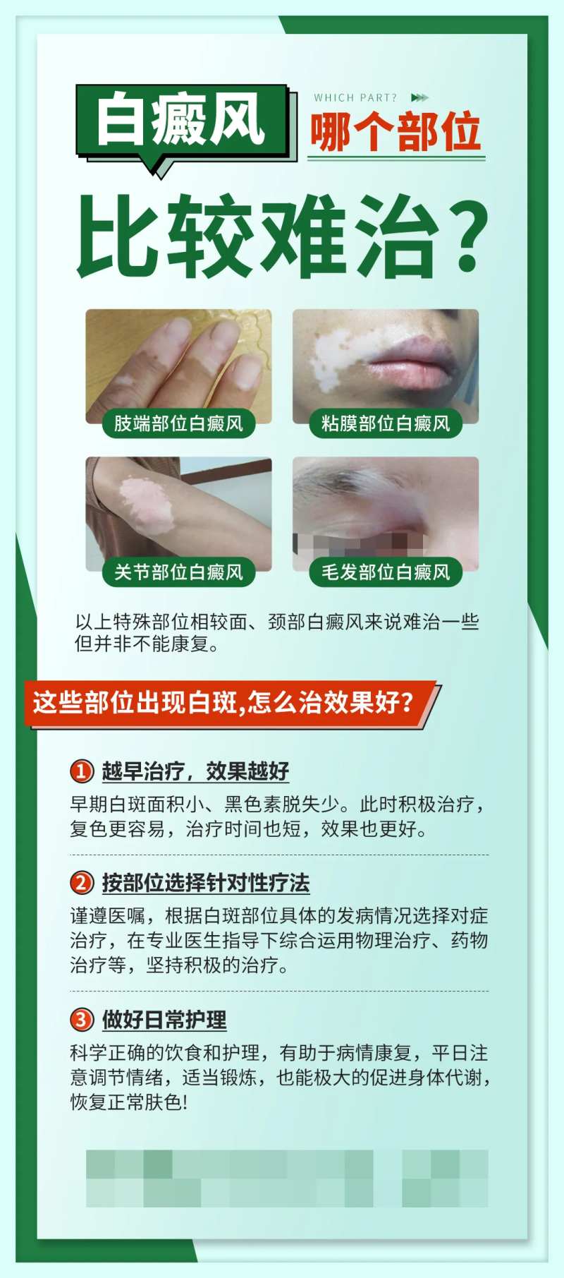 绿色科普医疗常识指南白癜风海报-采灵感-cailinggan.com