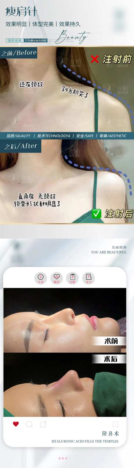 案例对比图-采灵感-https://www.cailinggan.com/