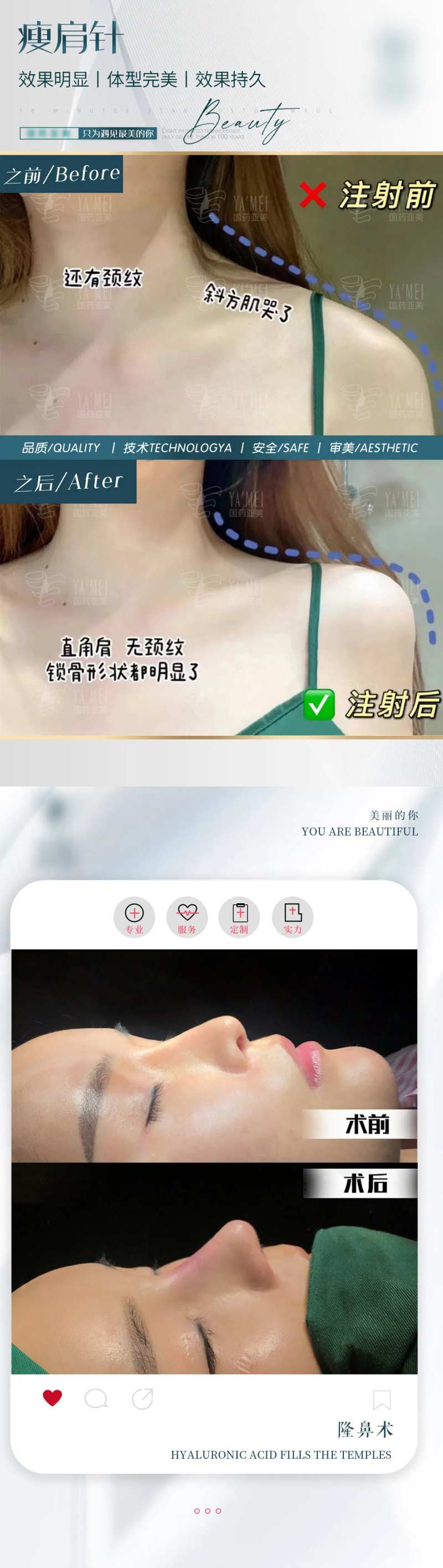 案例对比图-采灵感-cailinggan.com