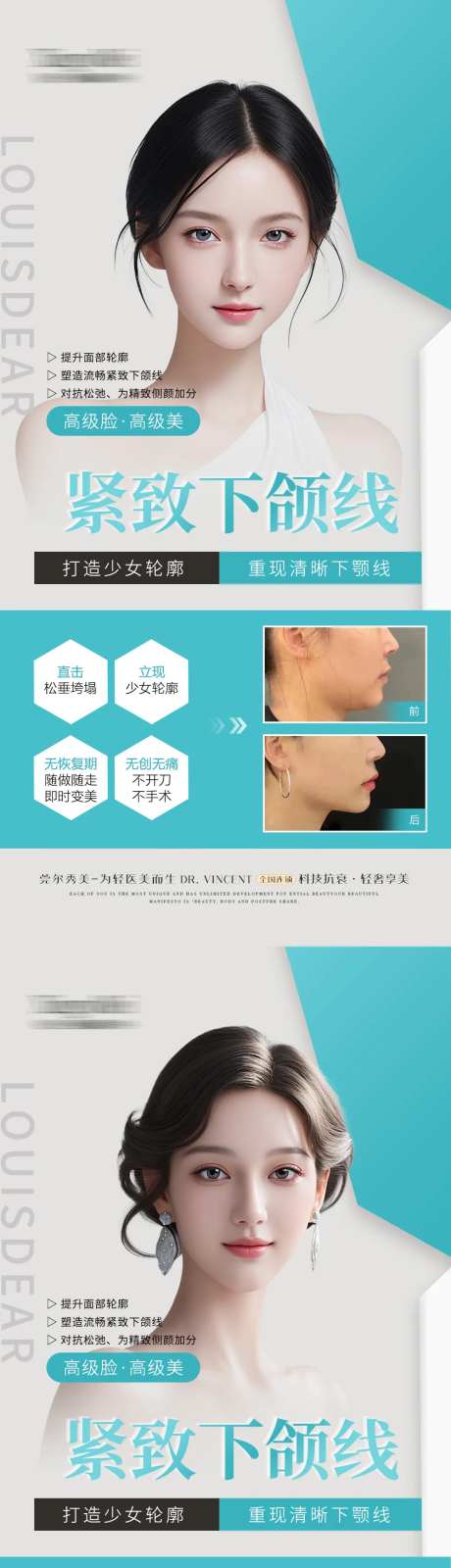 医美下颌缘案例海报-采灵感-https://www.cailinggan.com/