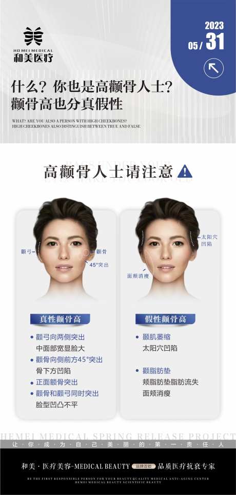 真假性颧骨科普海报-采灵感-https://www.cailinggan.com/