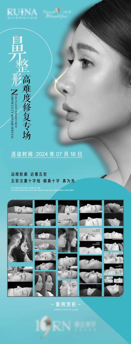 高难度鼻整形修复-采灵感-https://www.cailinggan.com/