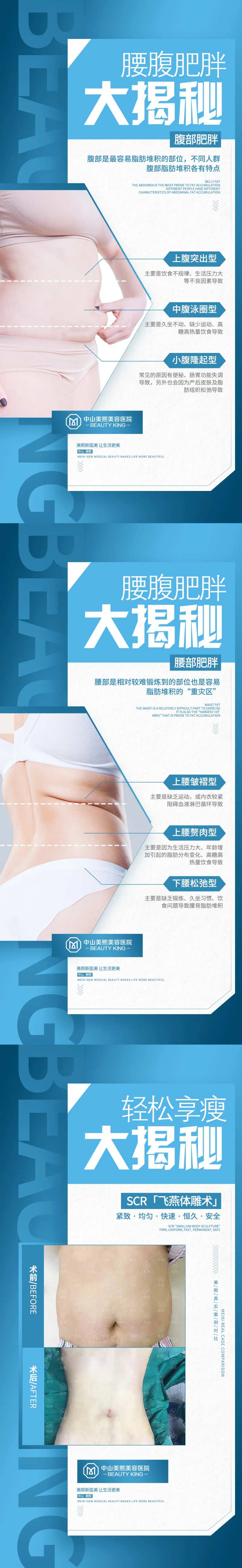 腰腹肥胖大揭秘宣传系列海报-采灵感-cailinggan.com