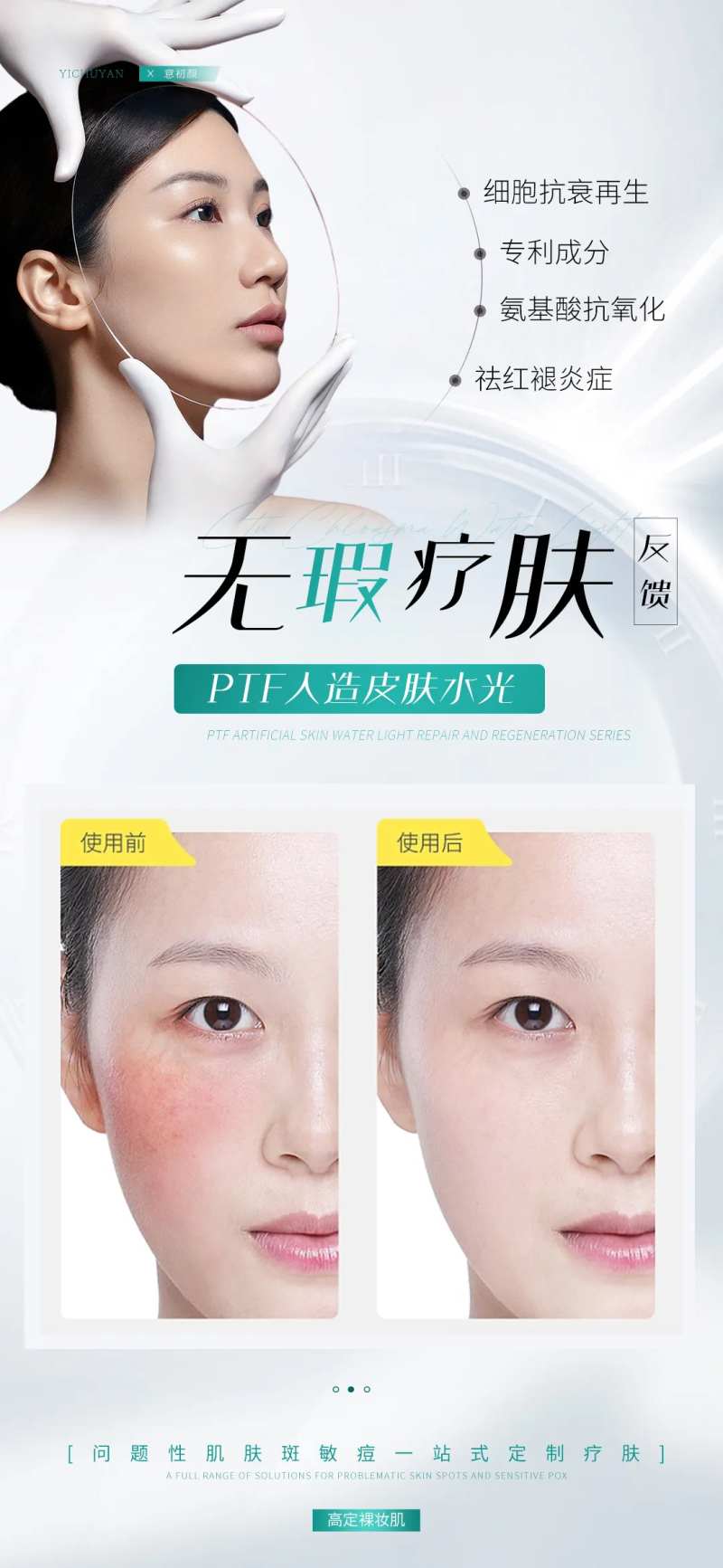 长沙医美美容祛斑美白痘痘模特对比简约-采灵感-cailinggan.com