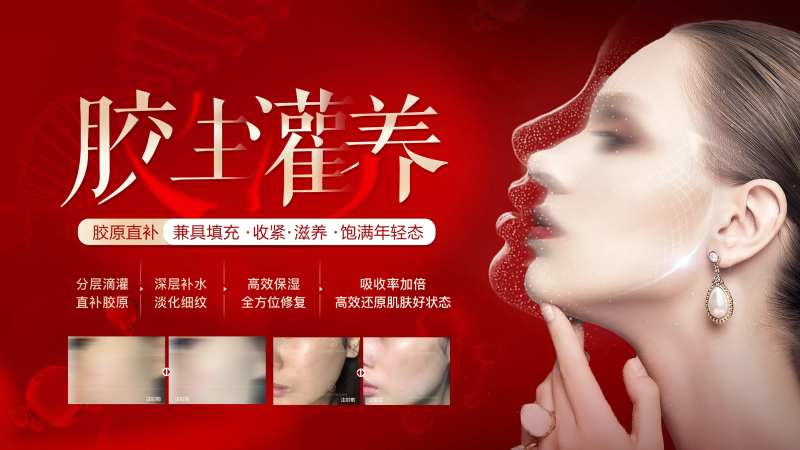 胶生灌养banner-采灵感-cailinggan.com
