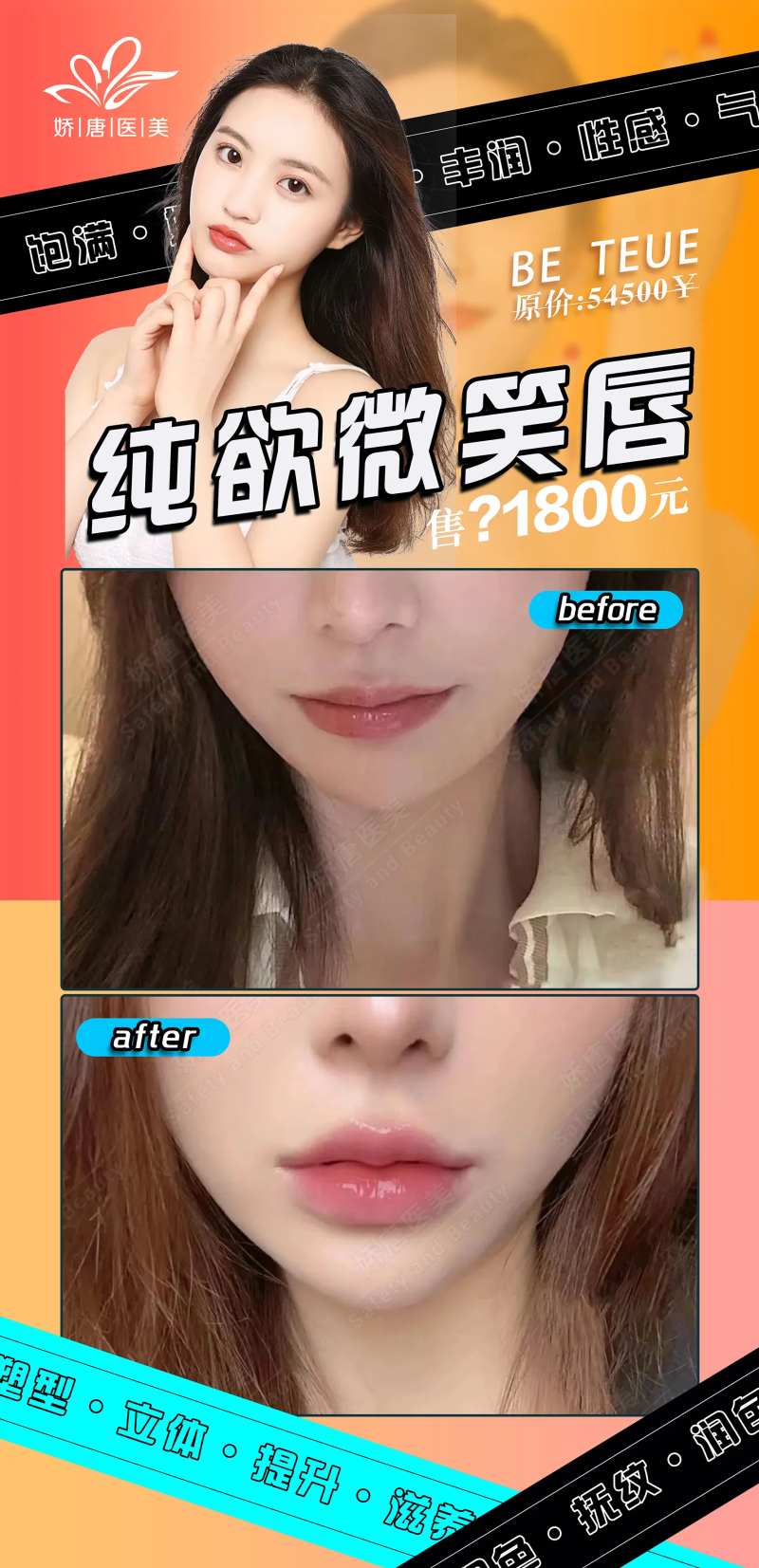 医美整形微笑唇-采灵感-cailinggan.com