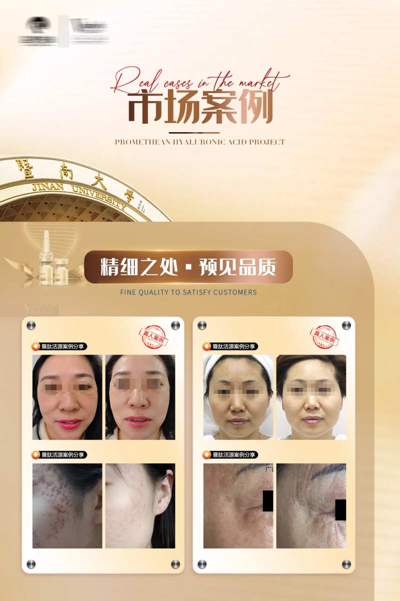 医美案例分享海报展板-采灵感-cailinggan.com