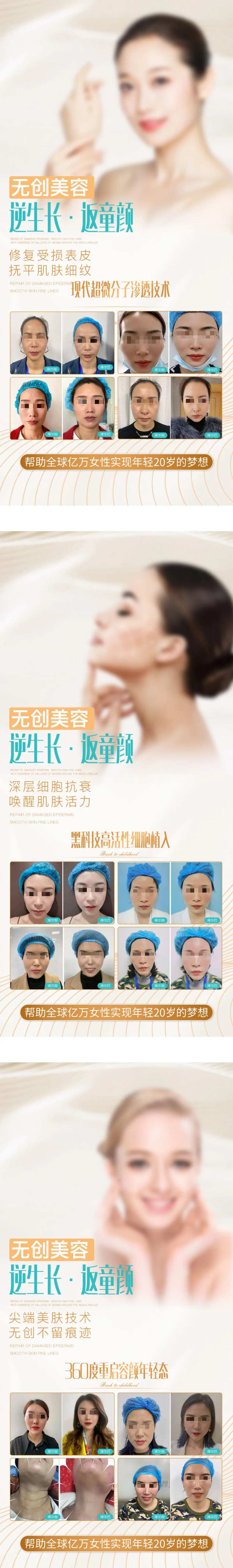 医美美容美业无创美容案例对比系列海报-采灵感-cailinggan.com
