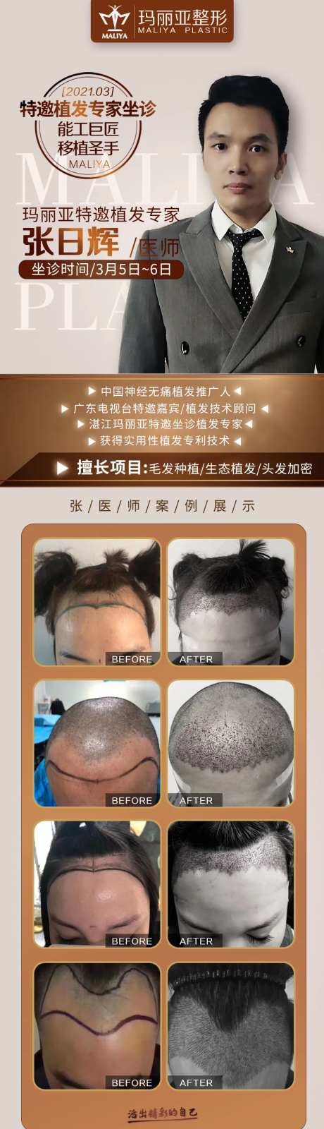 医美整形植发专家介绍案例-采灵感-https://www.cailinggan.com/