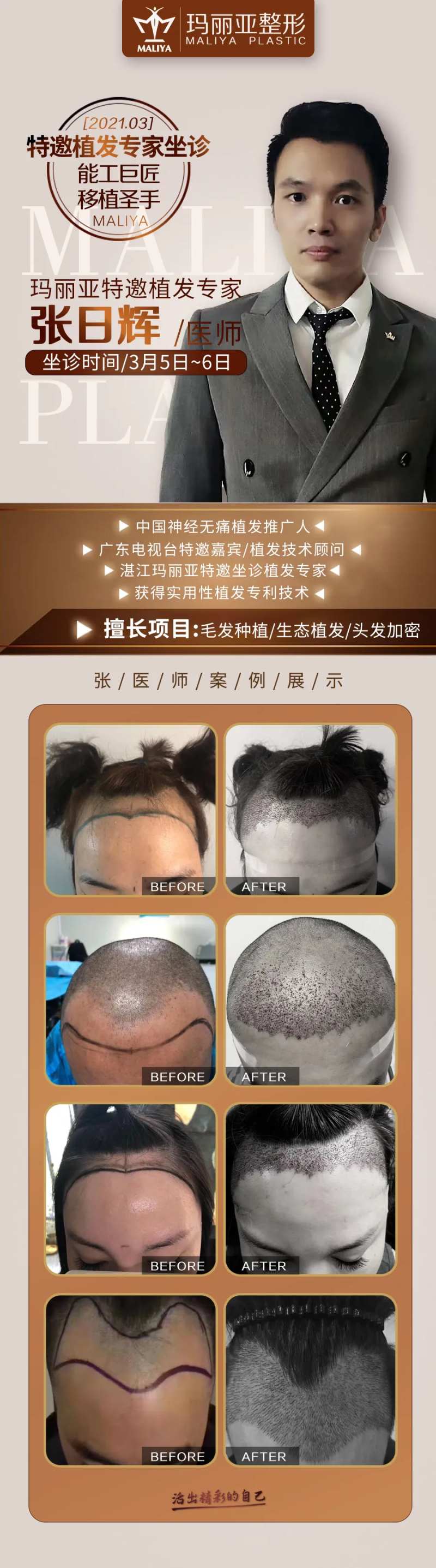 医美整形植发专家介绍案例-采灵感-cailinggan.com