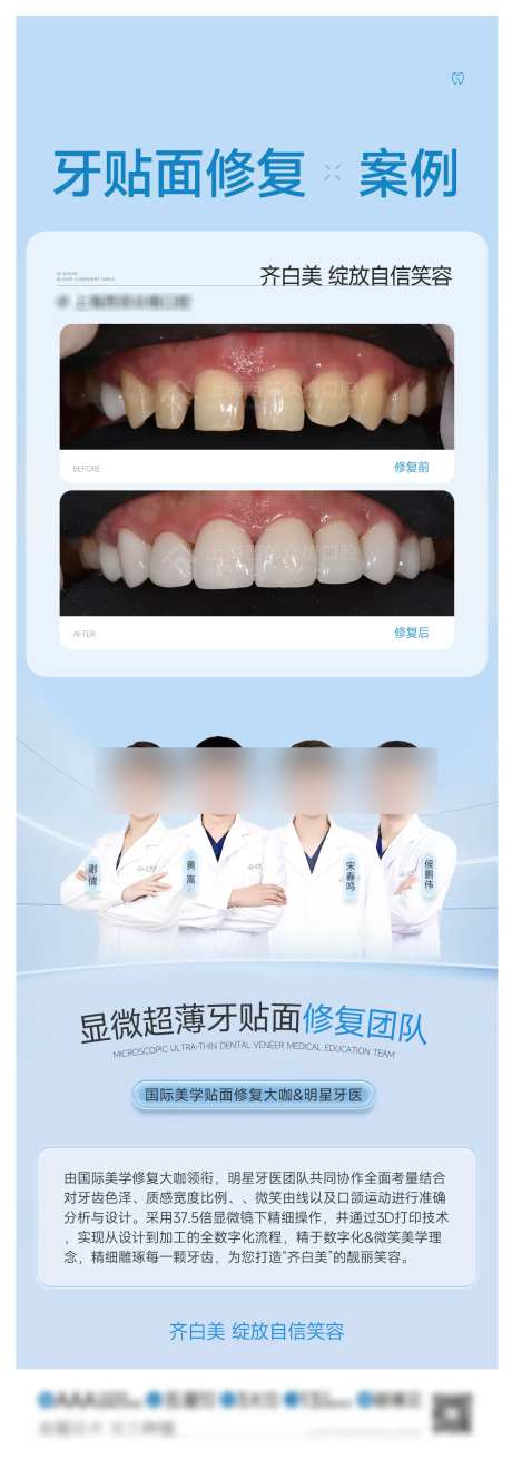 牙贴面修复案例展架-采灵感-https://www.cailinggan.com/