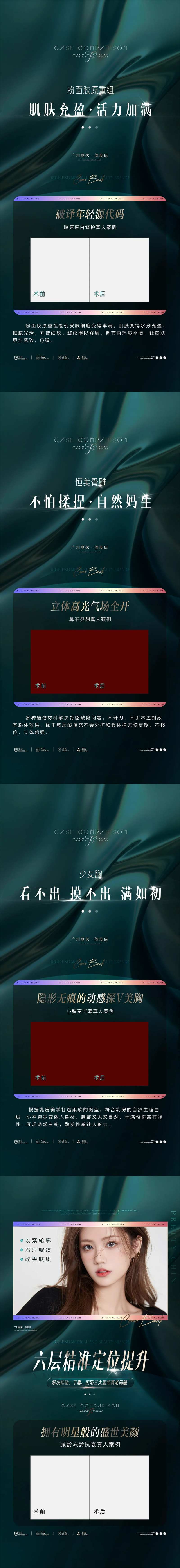 医美案例加推H5-采灵感-cailinggan.com