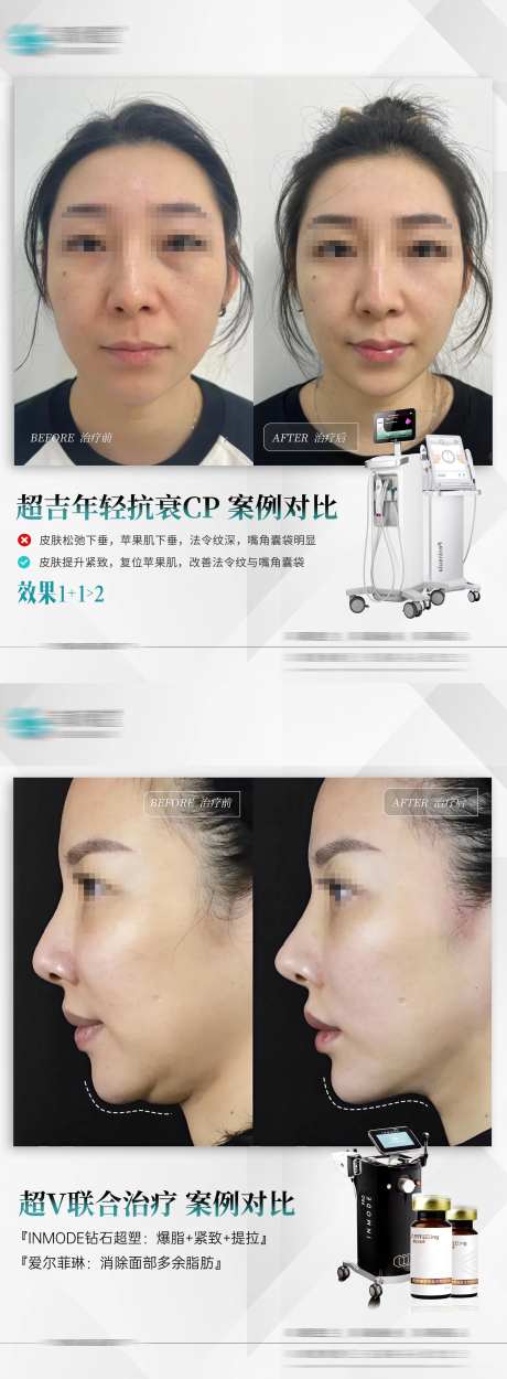 热超联合V脸案例-采灵感-https://www.cailinggan.com/