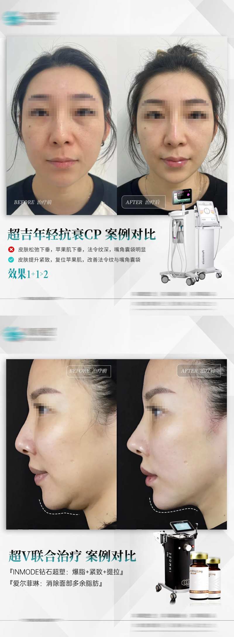 热超联合V脸案例-采灵感-cailinggan.com