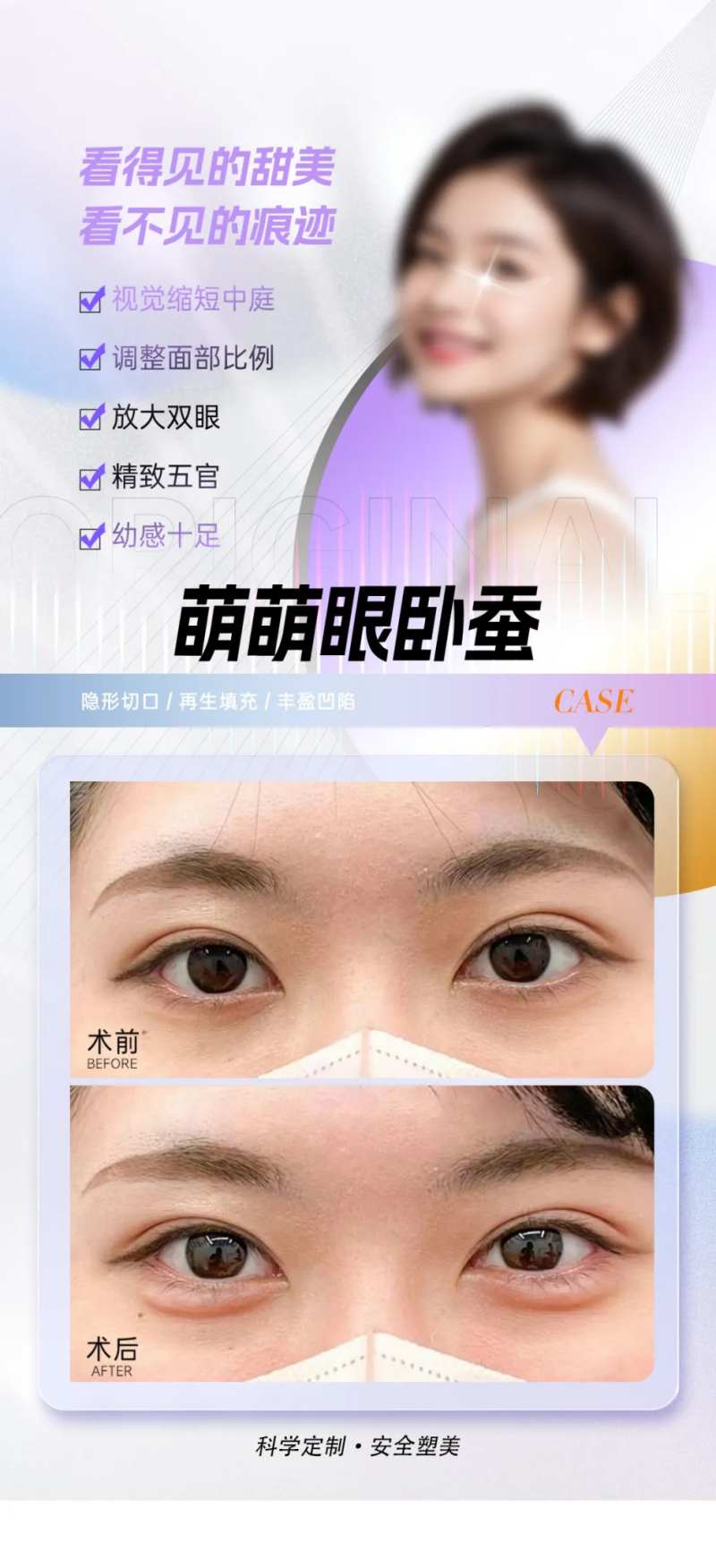 卧蚕填充案例海报-采灵感-cailinggan.com
