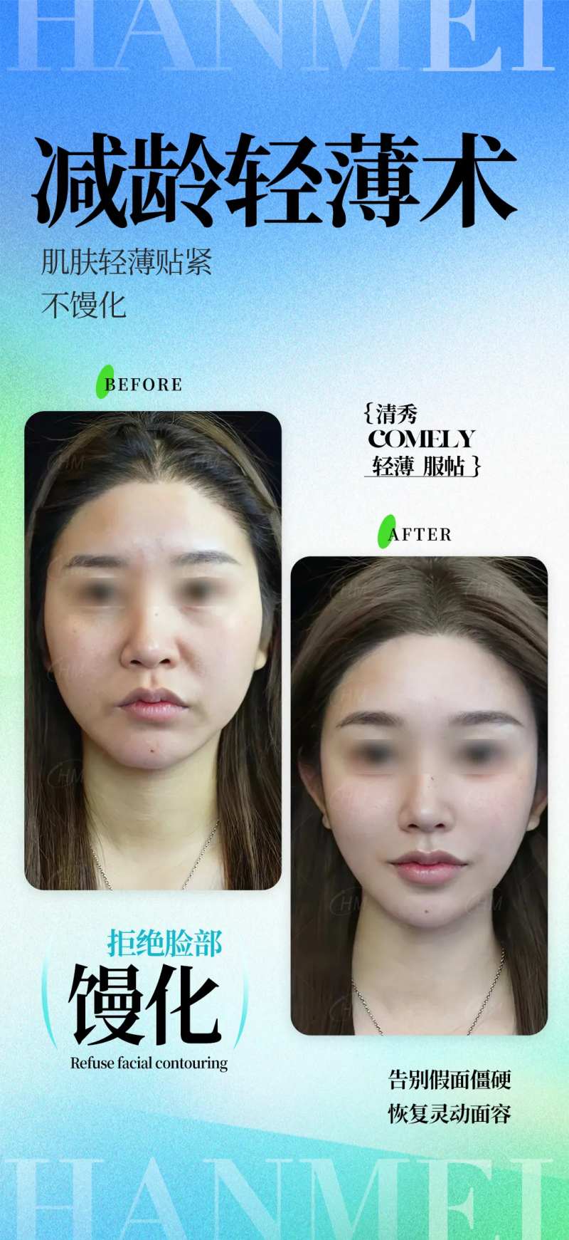 减龄轻薄术-采灵感-cailinggan.com