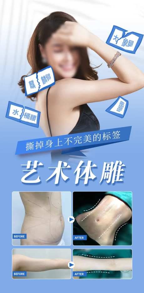 吸脂体雕塑形案例医美海报-采灵感-https://www.cailinggan.com/