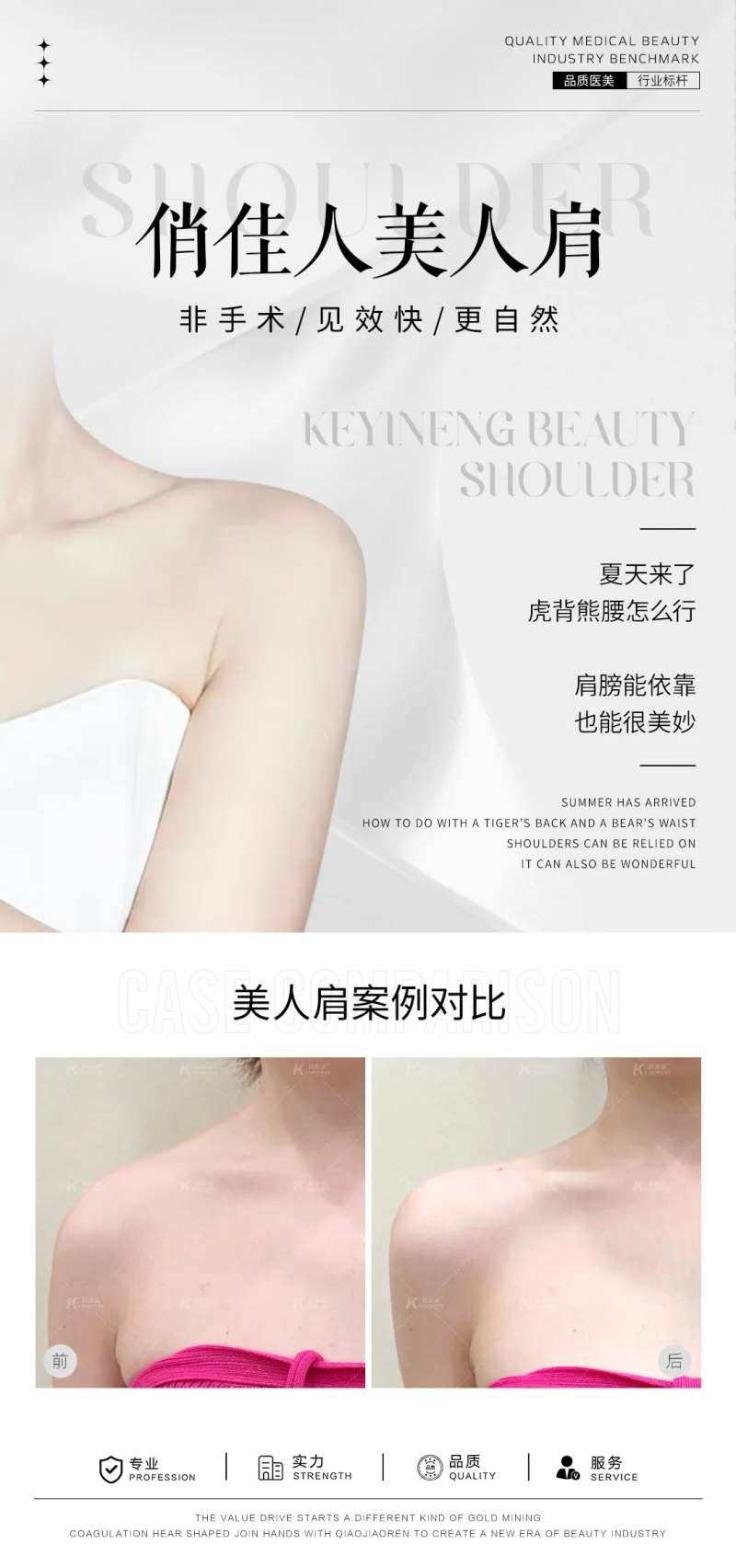 美人肩案例对比-采灵感-cailinggan.com