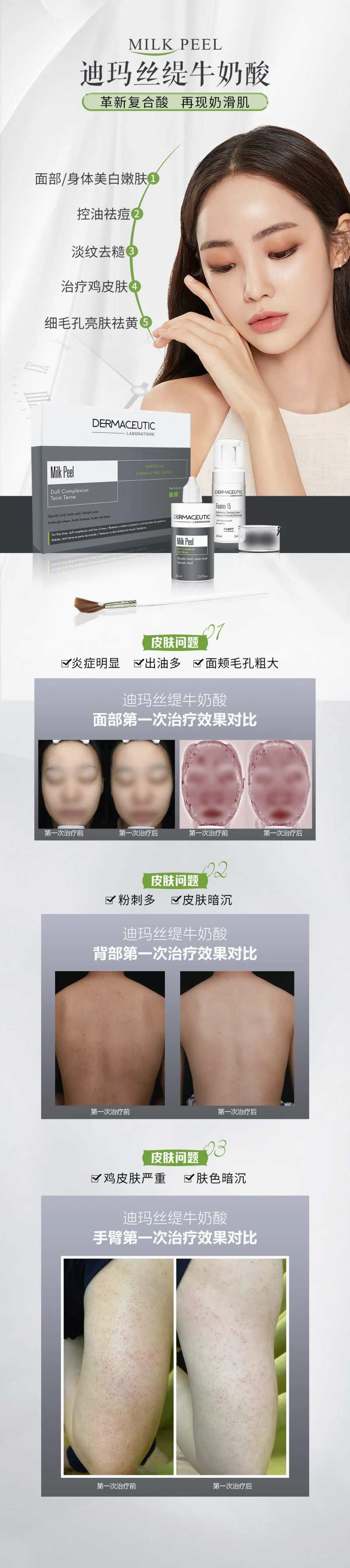 医美牛奶酸项目案例海报长图-采灵感-cailinggan.com
