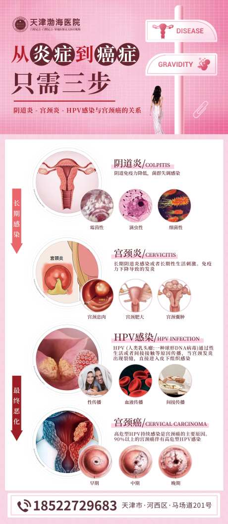 hpv妇科展架-采灵感-https://www.cailinggan.com/