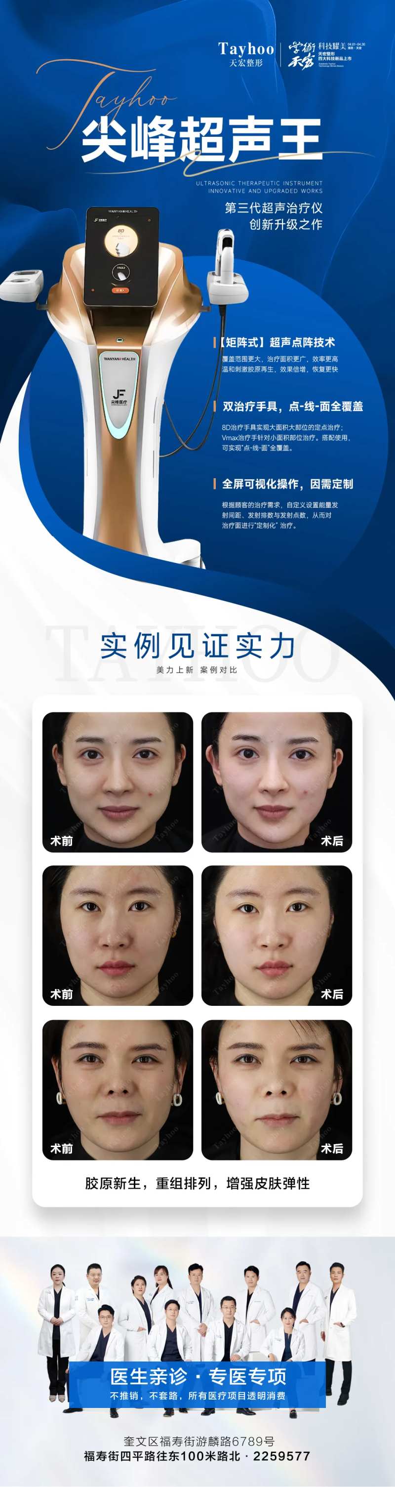 医美整形尖峰超声王功效仪器介绍-采灵感-cailinggan.com