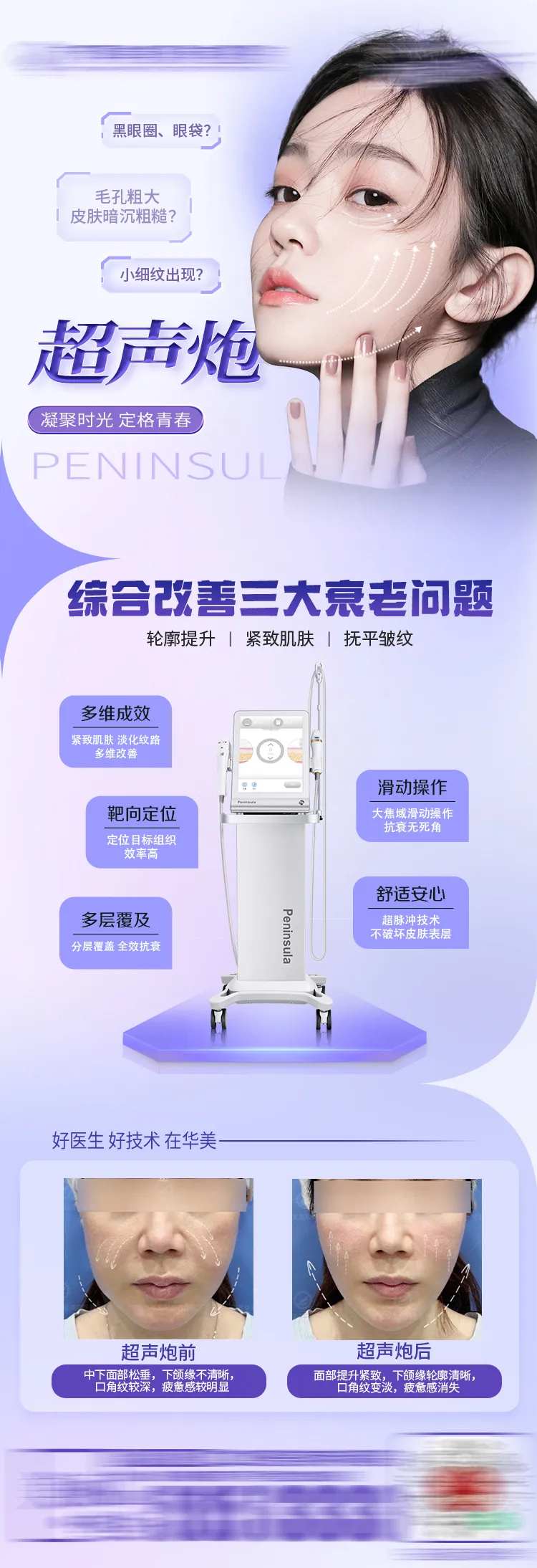 抗衰仪器超声炮长图-采灵感-cailinggan.com