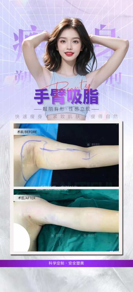 手臂吸脂-采灵感-https://www.cailinggan.com/