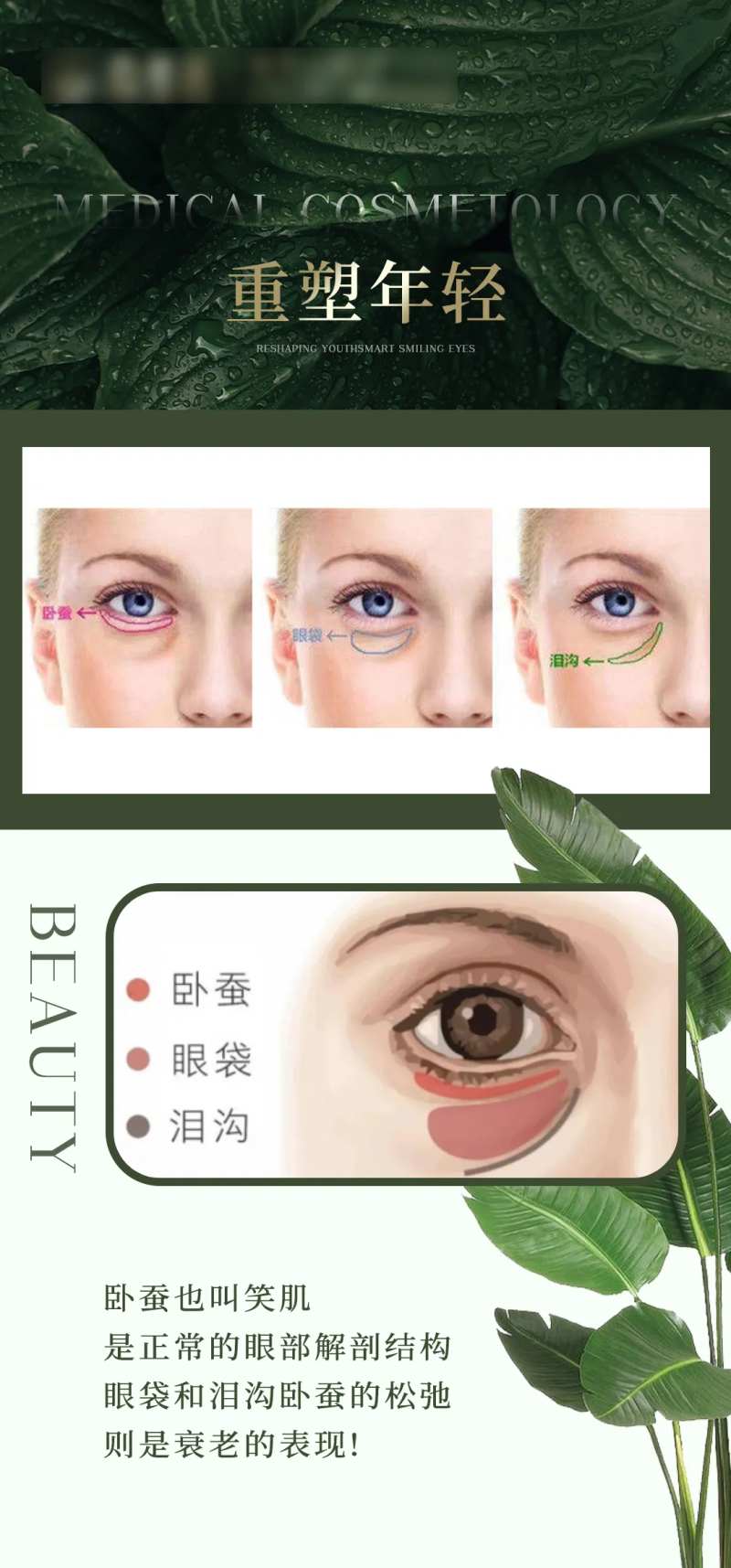 医美泪沟眼袋卧蚕重塑海报-采灵感-cailinggan.com
