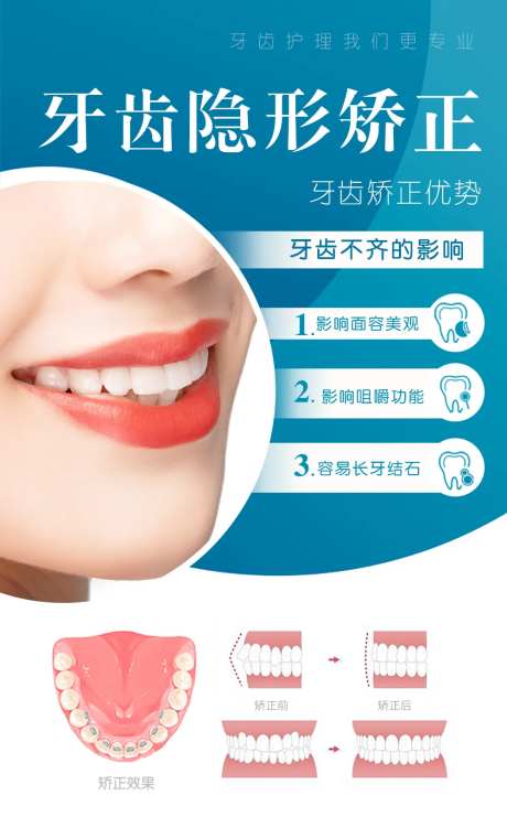 牙齿隐形矫正-采灵感-https://www.cailinggan.com/