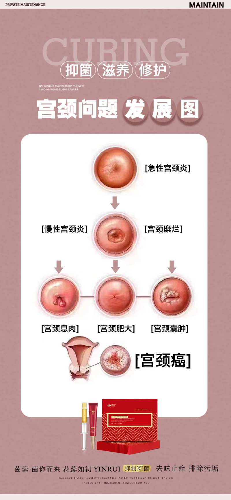 宫颈示意图-采灵感-cailinggan.com